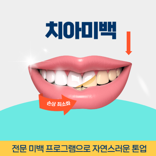 김해치과 김해시 치과 치아미백