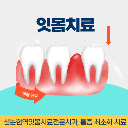 김해치과 김해시 치과 잇몸치료